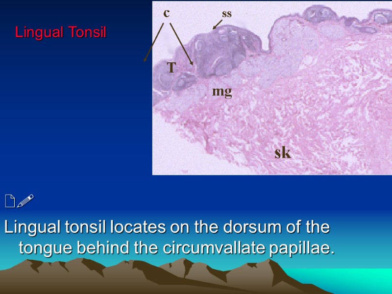 Lingual Tonsil     Lingual tonsil locates on the dorsum of the